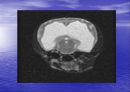 [뇌손상] 외상성 뇌손상[TBI]에 관해 26페이지