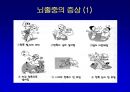 [뇌손상] 뇌졸중[중풍]이란 - 재활의학적 관점 33페이지