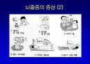 [뇌손상] 뇌졸중[중풍]이란 - 재활의학적 관점 34페이지