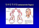 [뇌손상] 뇌졸중[중풍]이란 - 재활의학적 관점 35페이지