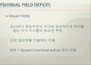 뇌손상 - Neglect & VFD[Visual Field Deficit]에 대해서 16페이지