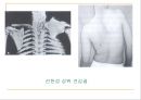 [소아치료] 소아의 질환별 물리치료 4페이지
