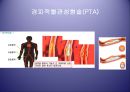 [의학] 뇌졸중 - 뇌졸중의 치료방법 16페이지