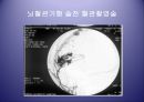 [의학] 뇌졸중 - 뇌졸중의 치료방법 26페이지
