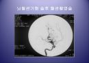 [의학] 뇌졸중 - 뇌졸중의 치료방법 28페이지