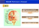 [뇌손상] 파킨슨병[Parkinson’s Disease]에 관해 2페이지