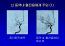 [의학] 뇌경색의 치료 5페이지
