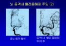 [의학] 뇌경색의 치료 6페이지