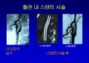 [의학] 뇌경색의 치료 7페이지