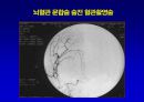 [의학] 뇌경색의 치료 15페이지
