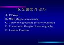 [의학] 뇌졸중 환자의 간호 15페이지