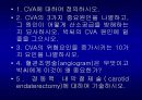 [의학] 뇌졸중 환자의 간호 48페이지
