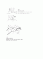 [물리치료] 진행성 근 이영양증[Progressive Muscular Dystrophy,PMD]환자에 대한 이해와 운동치료 3페이지