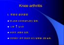 TKR(Total Knee Replacement)슬관절 대치술 PPT 7페이지