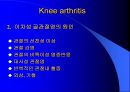 TKR(Total Knee Replacement)슬관절 대치술 PPT 8페이지