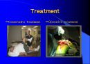 TKR(Total Knee Replacement)슬관절 대치술 PPT 10페이지