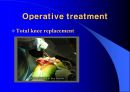 TKR(Total Knee Replacement)슬관절 대치술 PPT 12페이지
