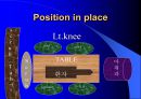 TKR(Total Knee Replacement)슬관절 대치술 PPT 16페이지