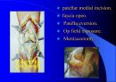 TKR(Total Knee Replacement)슬관절 대치술 PPT 25페이지