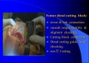 TKR(Total Knee Replacement)슬관절 대치술 PPT 27페이지