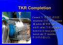 TKR(Total Knee Replacement)슬관절 대치술 PPT 30페이지