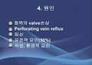 Varicose veins(하지정맥류).ppt 6페이지