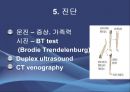 Varicose veins(하지정맥류).ppt 7페이지