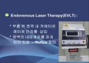 Varicose veins(하지정맥류).ppt 13페이지