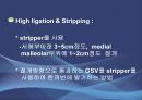 Varicose veins(하지정맥류).ppt 15페이지