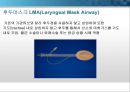 general anesthesia(전신마취).PPT 14페이지