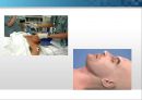 general anesthesia(전신마취).PPT 16페이지