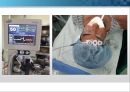 general anesthesia(전신마취).PPT 18페이지