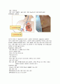 투석환자혈관 종류와 간호 3페이지