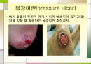 욕창관리 및 예방.ppt 3페이지