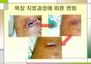 욕창관리 및 예방.ppt 30페이지