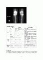 성인 골관절염간호과정 - 골관절염과 슬관절 케이스 스터디 (CASE STUDY ABOUT OSTEOARTHRITIS AND TOTAL KNEE REPLACEMENT) 9페이지
