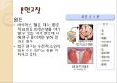 노인 치매 간호과정 Case study.ppt 4페이지