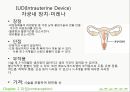 모성 가족계획과 피임 - 가족계획과 피임법.ppt 33페이지