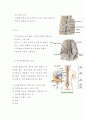 추간판 탈출증 (HIVD: Herniated intervertebral disc) 5페이지