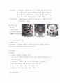 추간판 탈출증 (HIVD: Herniated intervertebral disc) 11페이지