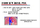 [의학] 선천성 심장질환[Congenital heart disease]에 관해 12페이지