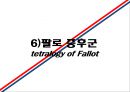 [의학] 선천성 심장질환[Congenital heart disease]에 관해 25페이지