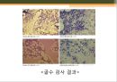 [조직학] 검체의 절취와 처리법, 조직 검체의 종류 7페이지