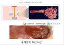 [조직학] 검체의 절취와 처리법, 조직 검체의 종류 16페이지