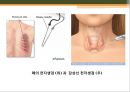 [조직학] 검체의 절취와 처리법, 조직 검체의 종류 22페이지