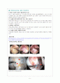 [의학] ACL 재건술에 관하여 5페이지