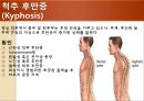 [물리치료] 척추에 대한 질환 3페이지