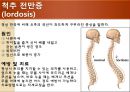 [물리치료] 척추에 대한 질환 4페이지