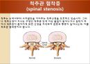 [물리치료] 척추에 대한 질환 8페이지