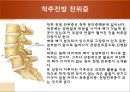 [물리치료] 척추에 대한 질환 10페이지